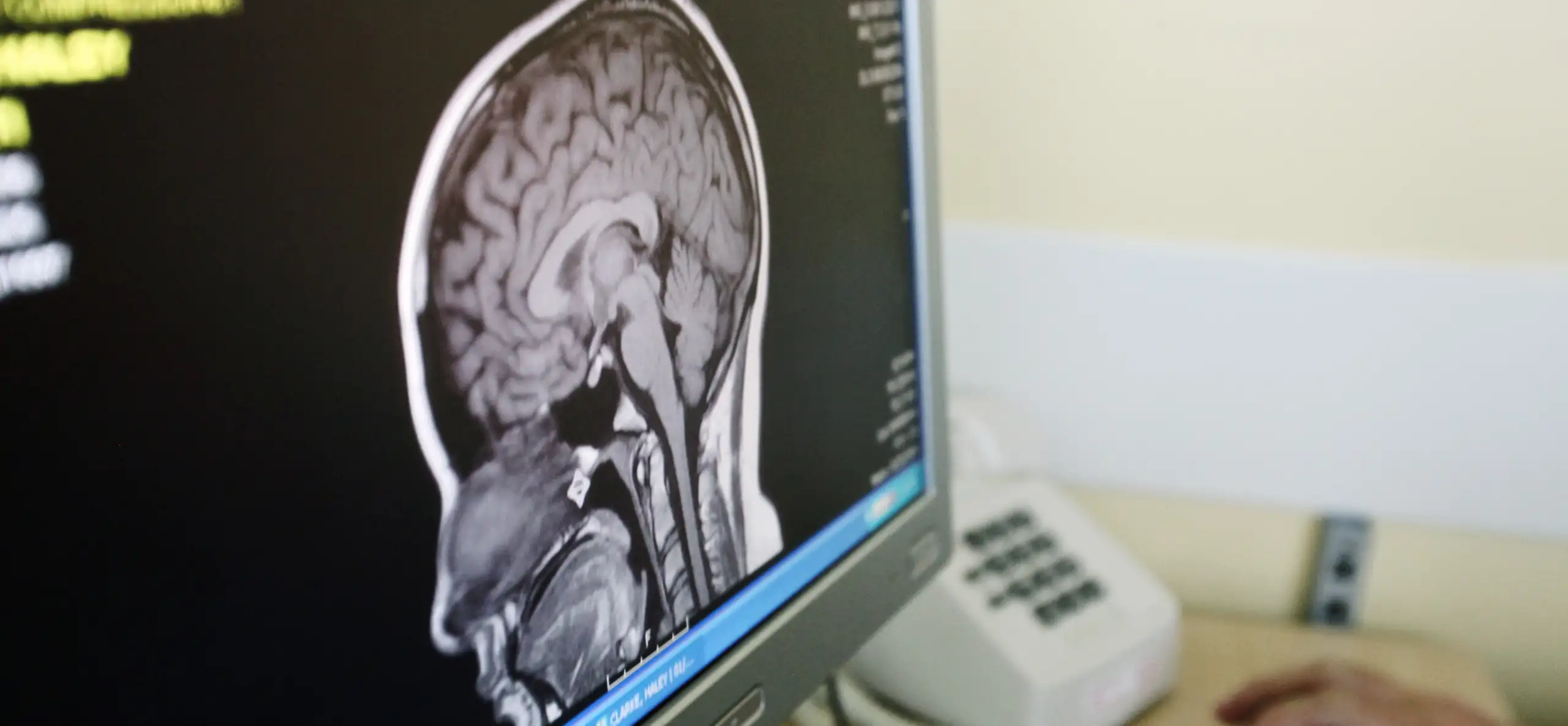 Brain scan