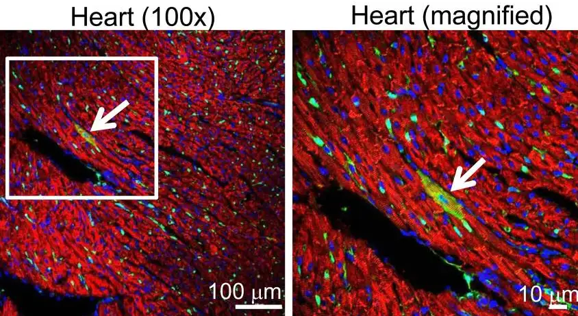 cardiomyocytes at microscopic level