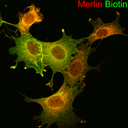 microscopic view of Merlin proteins in cells.
