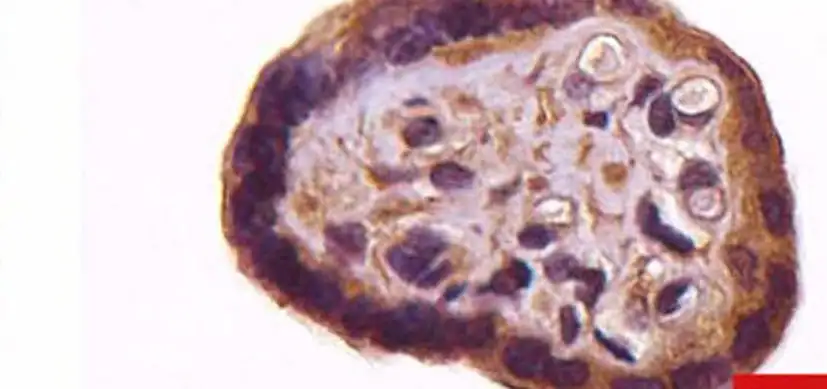 Molecular Signature Revealed for Placenta Hypermaturity - Research