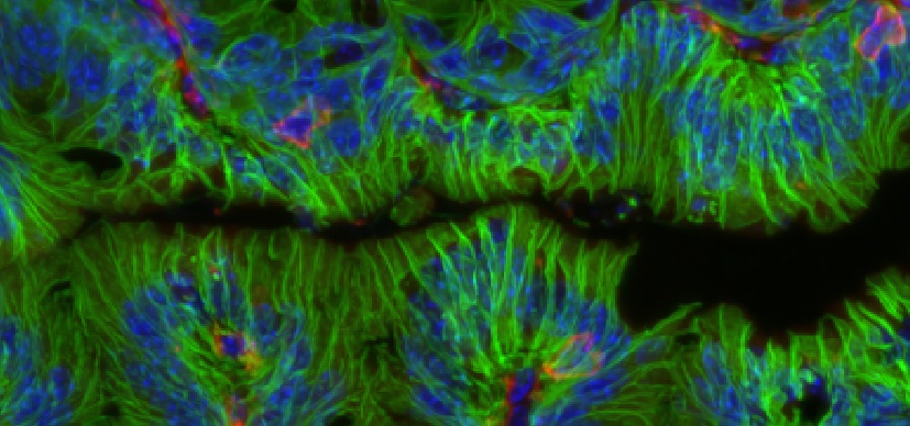 This confocal microscope image shows intestine tissue from a mouse that has been stained to visualize epithelial cells lining the intestinal lumen (EpCAM, green) and underlying immune cells (CD45, red). Nuclei are stained with DAPI (blue).
