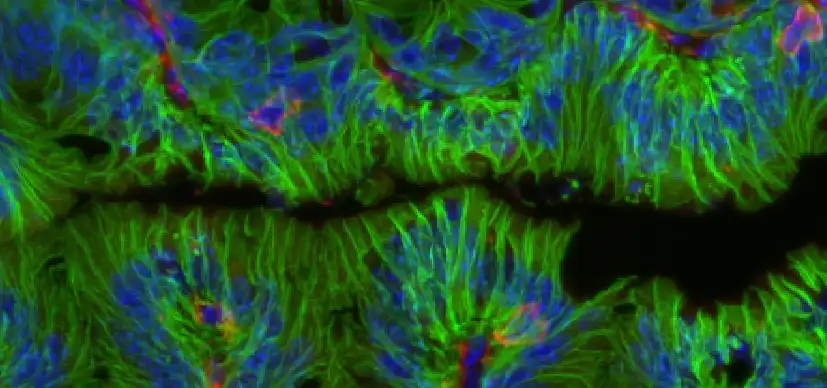 This confocal microscope image shows intestine tissue from a mouse that has been stained to visualize epithelial cells lining the intestinal lumen (EpCAM, green) and underlying immune cells (CD45, red). Nuclei are stained with DAPI (blue).
