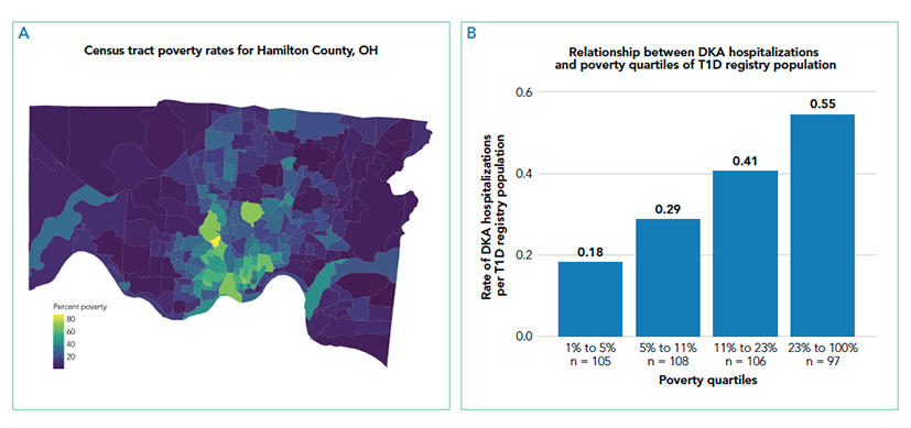 A map illustrating percent poverty displayed as a continuous variable based on census tract data; a bar chart of the number of diabetic ketoacidosis (DKA) hospitalizations per type 1 diabetes (T1D) registry population by poverty quartile