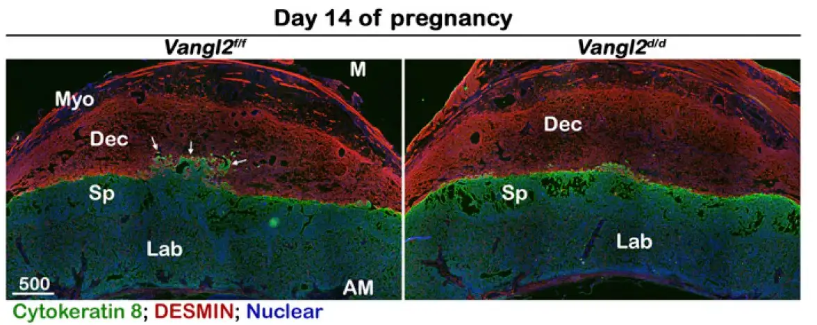 Side by side microscopic images of mouse placental tissue; one with active Vangl2, the other without.