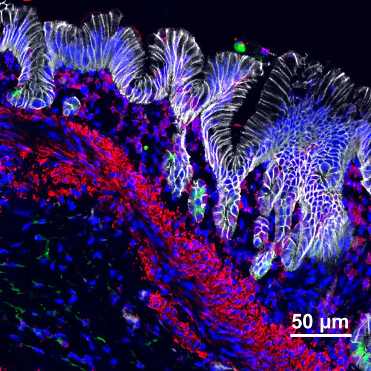 Multi-colored confocal image of stomach organoid tissues showing several types of functional cells.