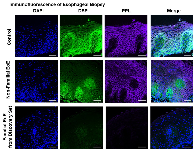 Collection of confocal images comparing familial EoE samples to controls and non-familial EoE
