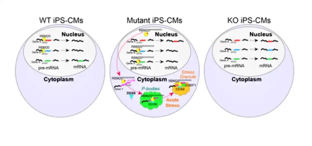 Side-by-side cell illustrations show activity in the cell cytoplasm occurs only with the mutant form of RBM20