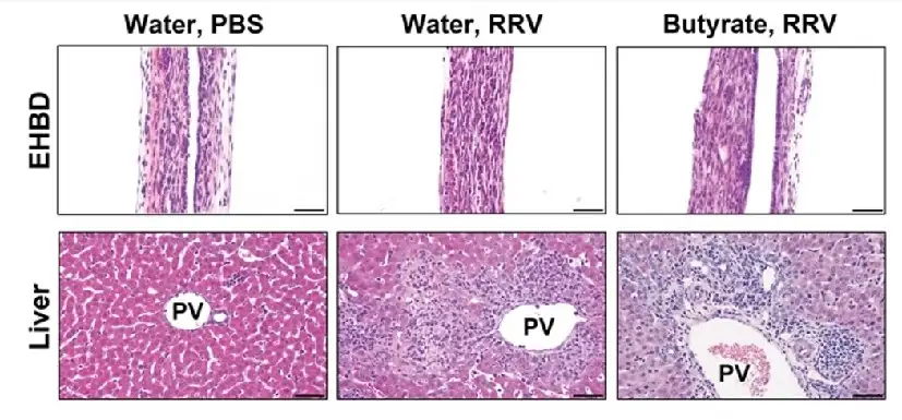 Microscope slides of mouse liver samples comparing outcomes from feeding with butyrate and without