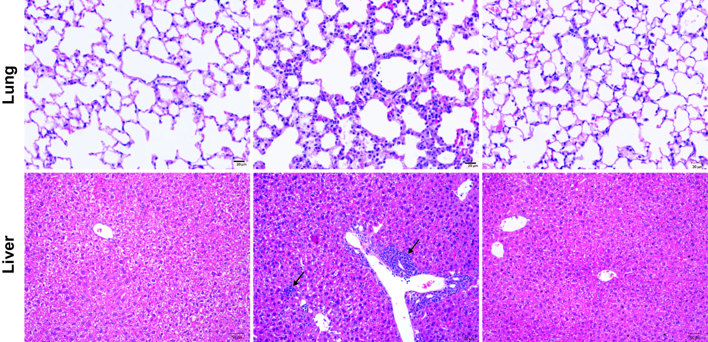 Microscope images of lung and liver tissue