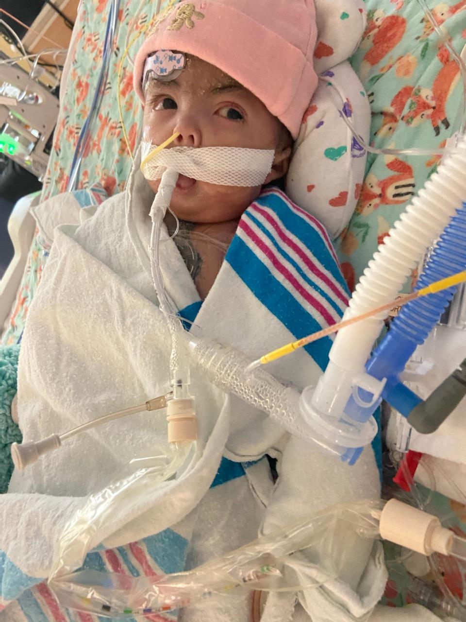 Baby connected to ventilator and monitoring devices.
