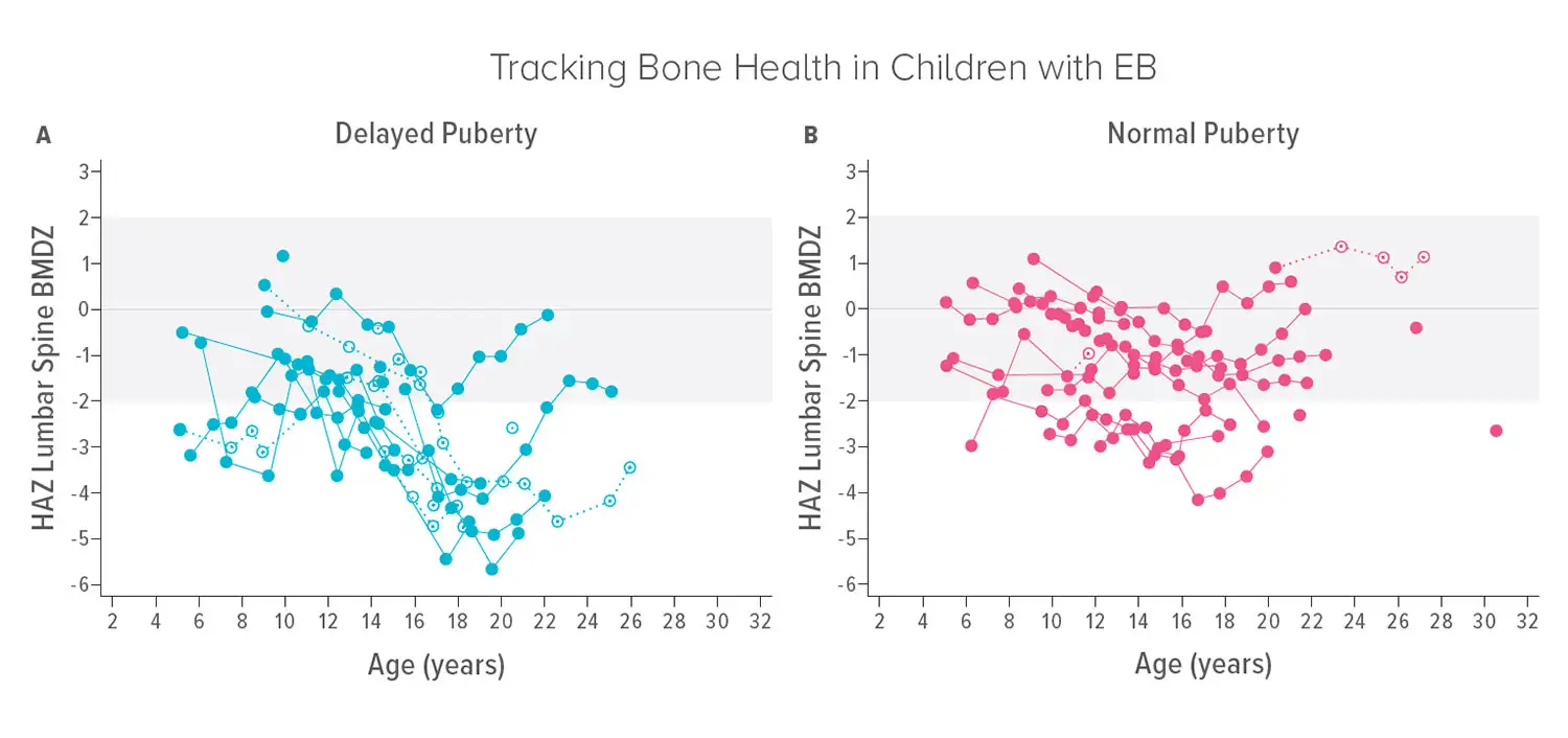 Bone marrow density scores dropped sharply among EB patients with delayed puberty (A) versus normal puberty (B). Dashed lines represent wheelchair users.