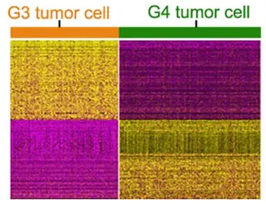 Active genes in group 3 medulloblastoma (gold) differ from active genes in group 4 tumors