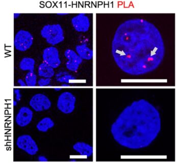 4-panel image shows tumor formation in control mice but not in mice that lack two critical enhancer genes.