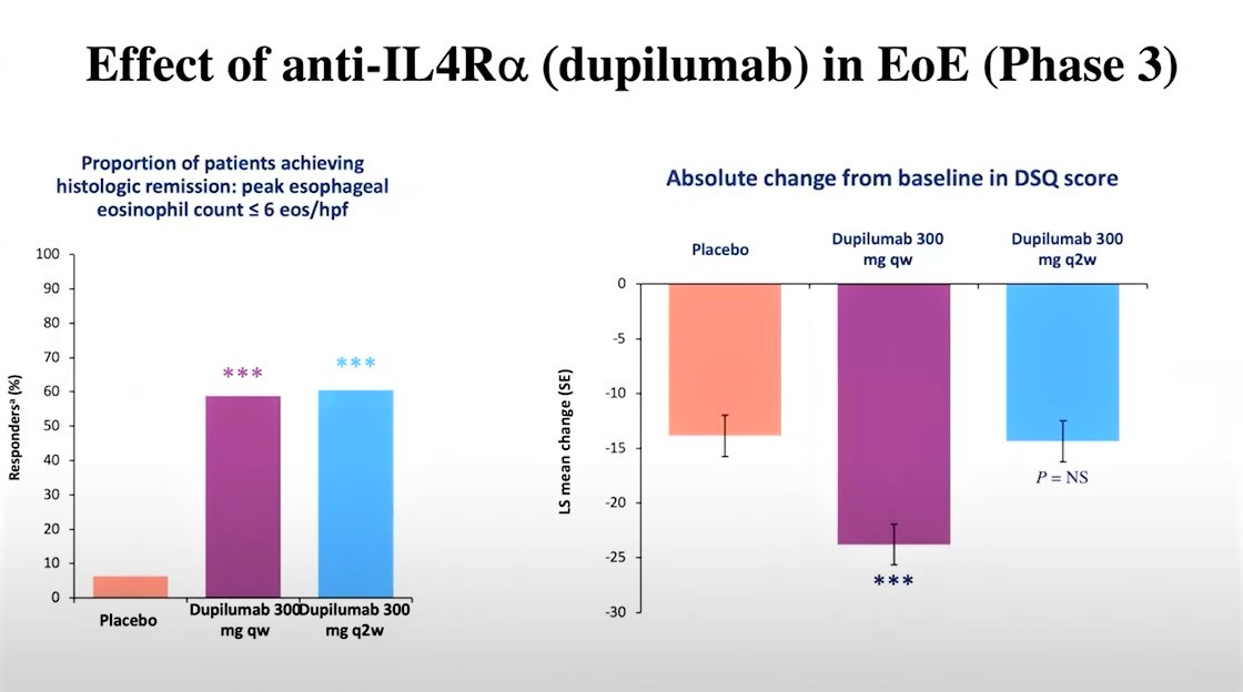 Chart illustrates that once-weekly dosing of dupilumab showed clear improvements in EoE symptoms, as measured by the Dysphagia Symptom Questionnaire (DSQ).