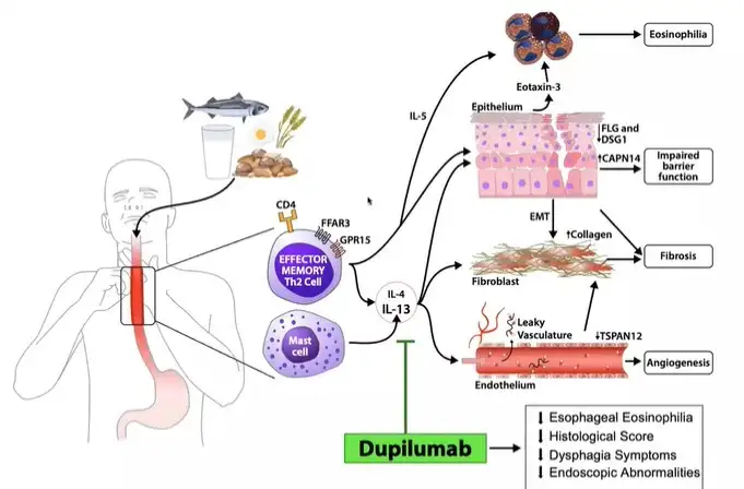 Illustration tracks the cascading biological process that occurs when foods trigger an eosinophilic esophageal reaction and pinpoints how the recently approved drug dupilumab helps improve disease symptoms.
