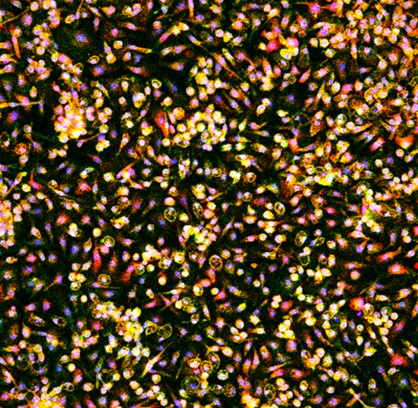 Microscope slide image of macrophage cells, shown as a field of multi-colored dots