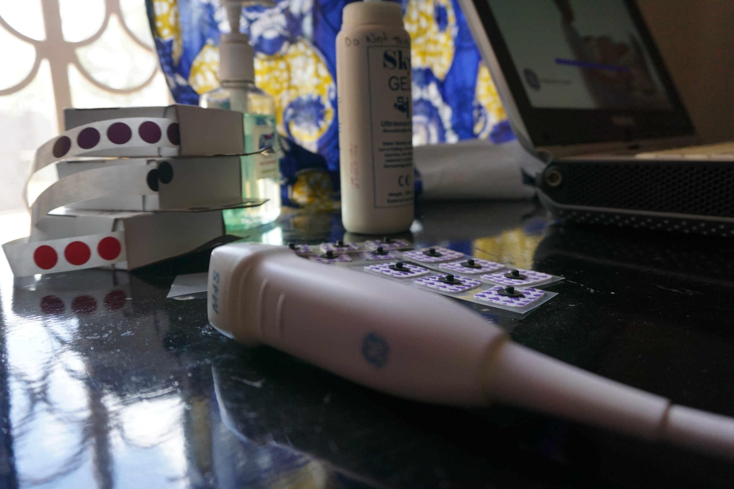 An ultrasound wand, stickers and related supplies rest on a table for later use in the GOAL study.