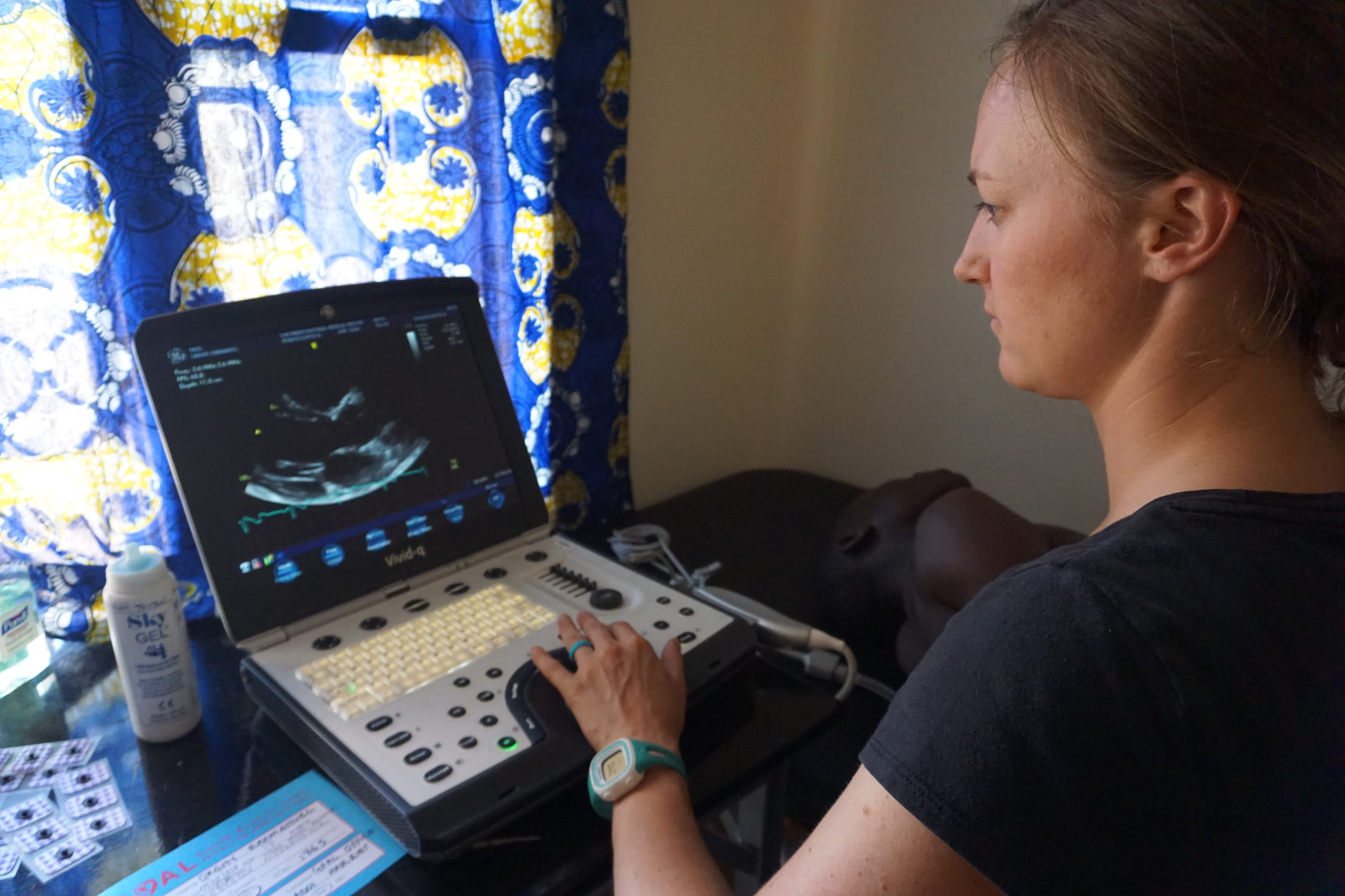 A GOAL study staff member in a small office in Uganda enters ultrasound information on a laptop computer.