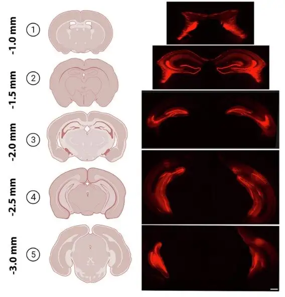 These representative images show the viral spread of GR knockdown cells along the dorso-ventral axis of the hippocampus, revealed by co-expression of mCherry. The mCherry expression shows affected dentate granule cells (DGCs), mossy cells (MCs) and pyramidal cells. Scale bar = 1 mm.