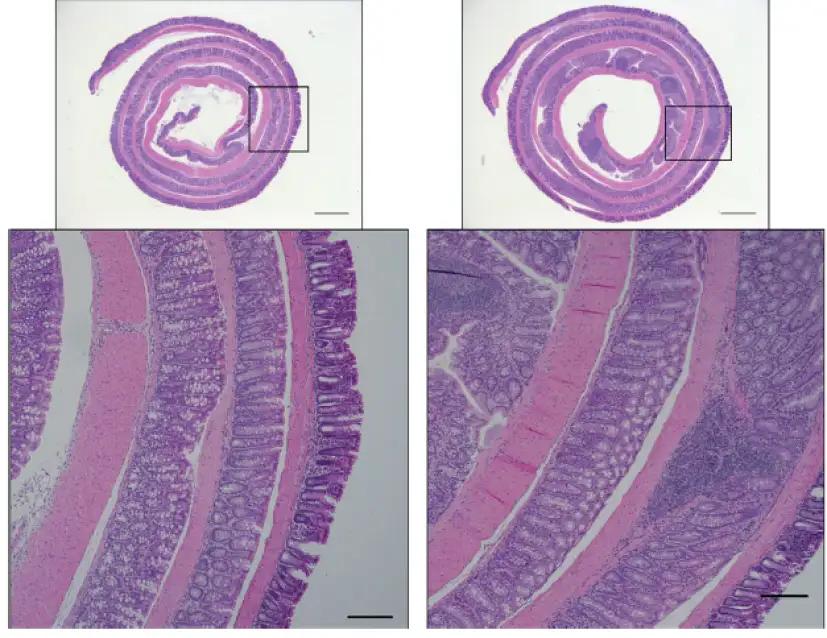 A box of 4 microscopic slide images of mouse intestine tissue. On the right, the tissues appear more damaged and inflamed.