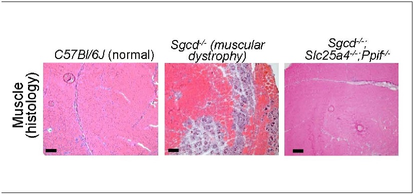Three microscope slides of mouse muscle tissue, shown side by side. The images illustrate how tissue from a mouse with muscular dystrophy closely resembles normal tissue when the mouse lacks two genes that control mitochondrial pore formation. When the genes are present, the the tissue appears damaged.