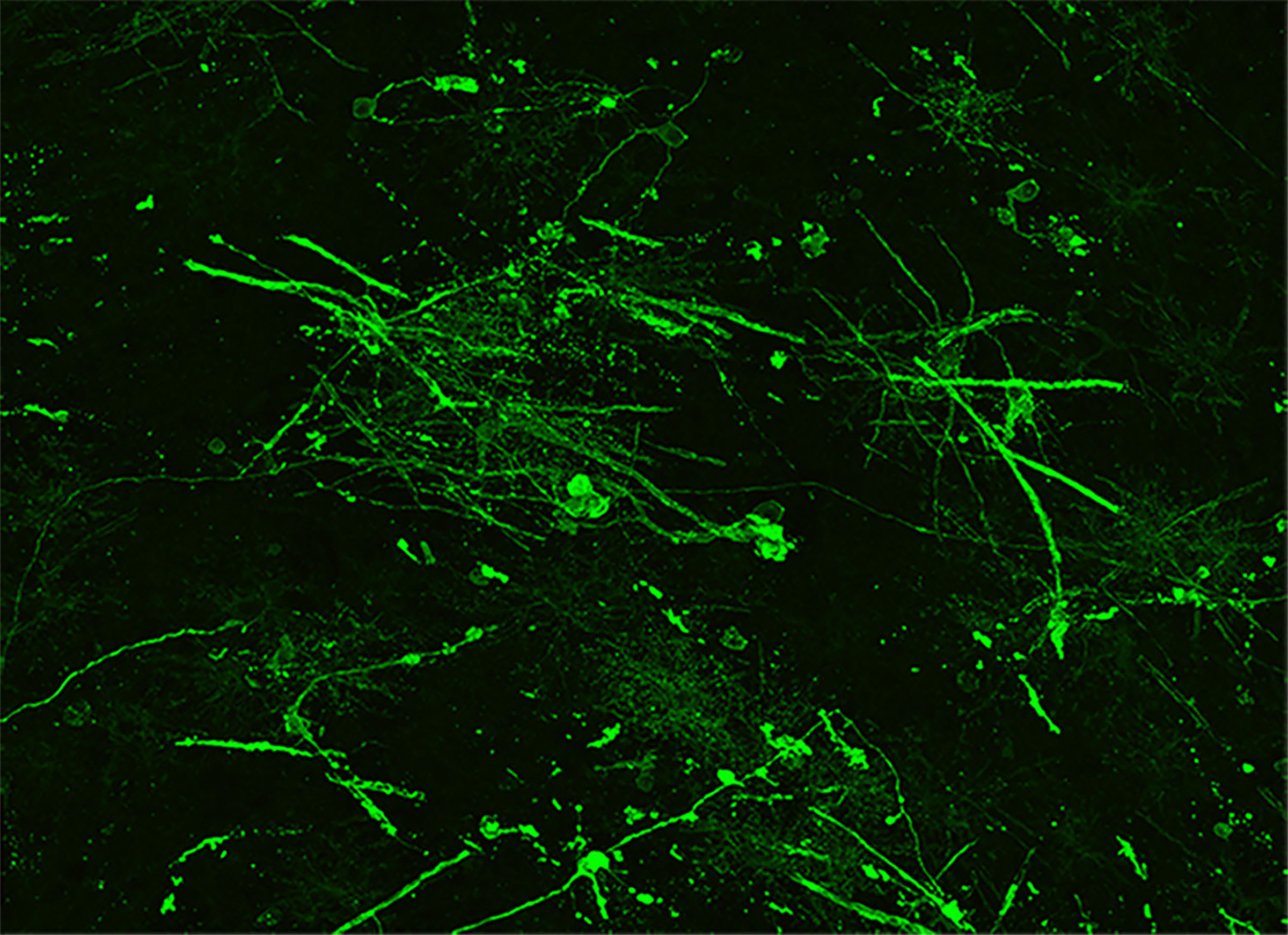 Bright green strands show how human brain cell organoids responded to treatment to enhance myelination.