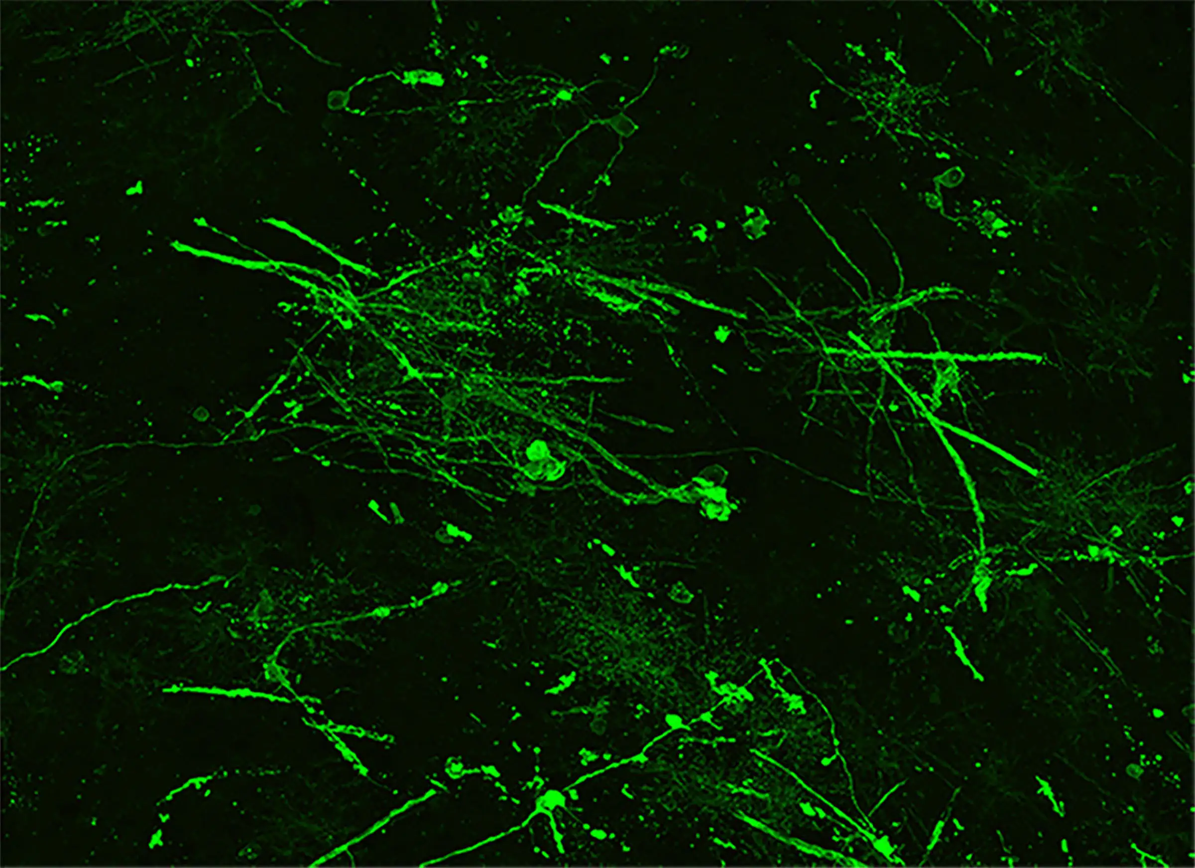 Bright green strands show how human brain cell organoids responded to treatment to enhance myelination.