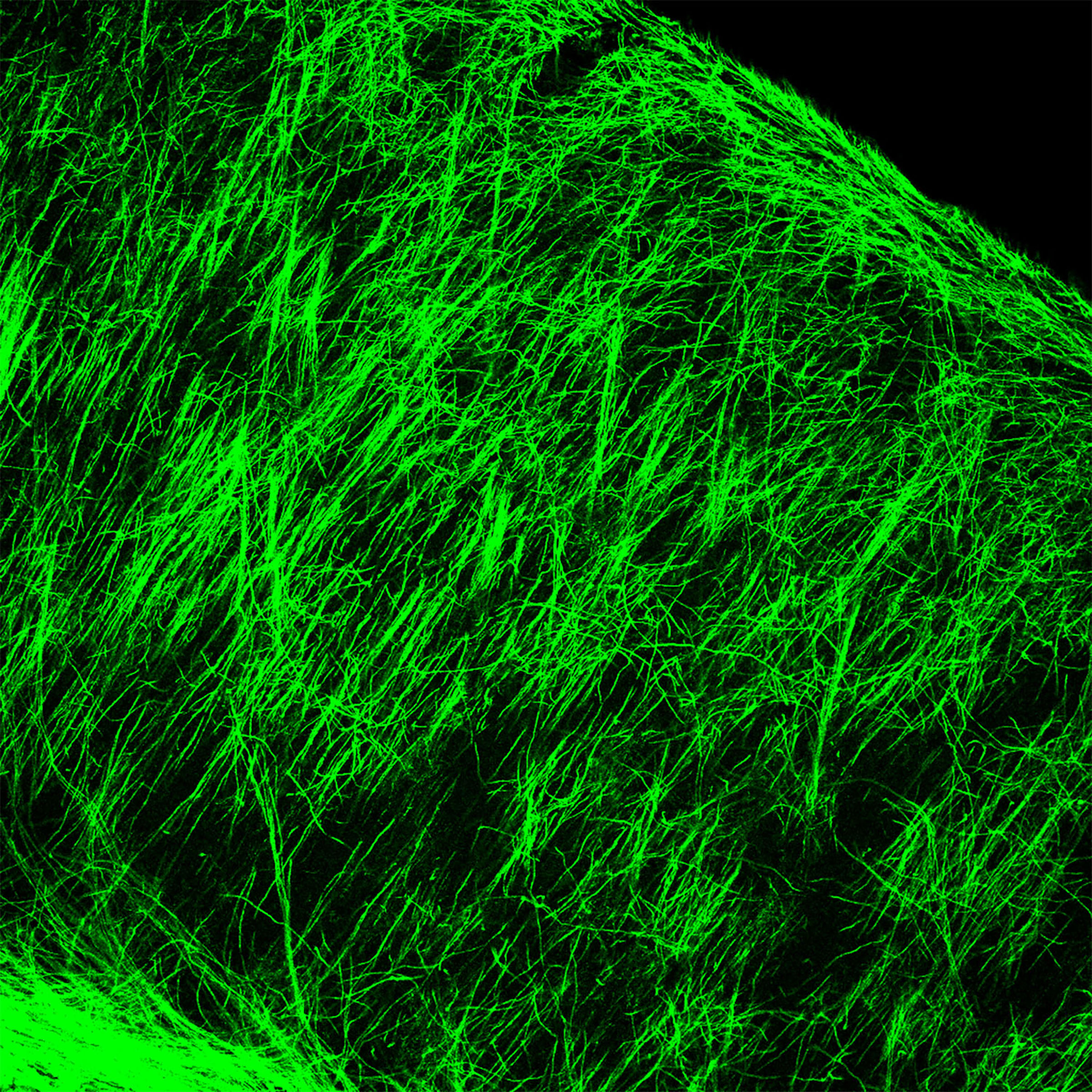 Outcome of remyelination treatment in a mouse model shown as a field of diagonal bright green strands.