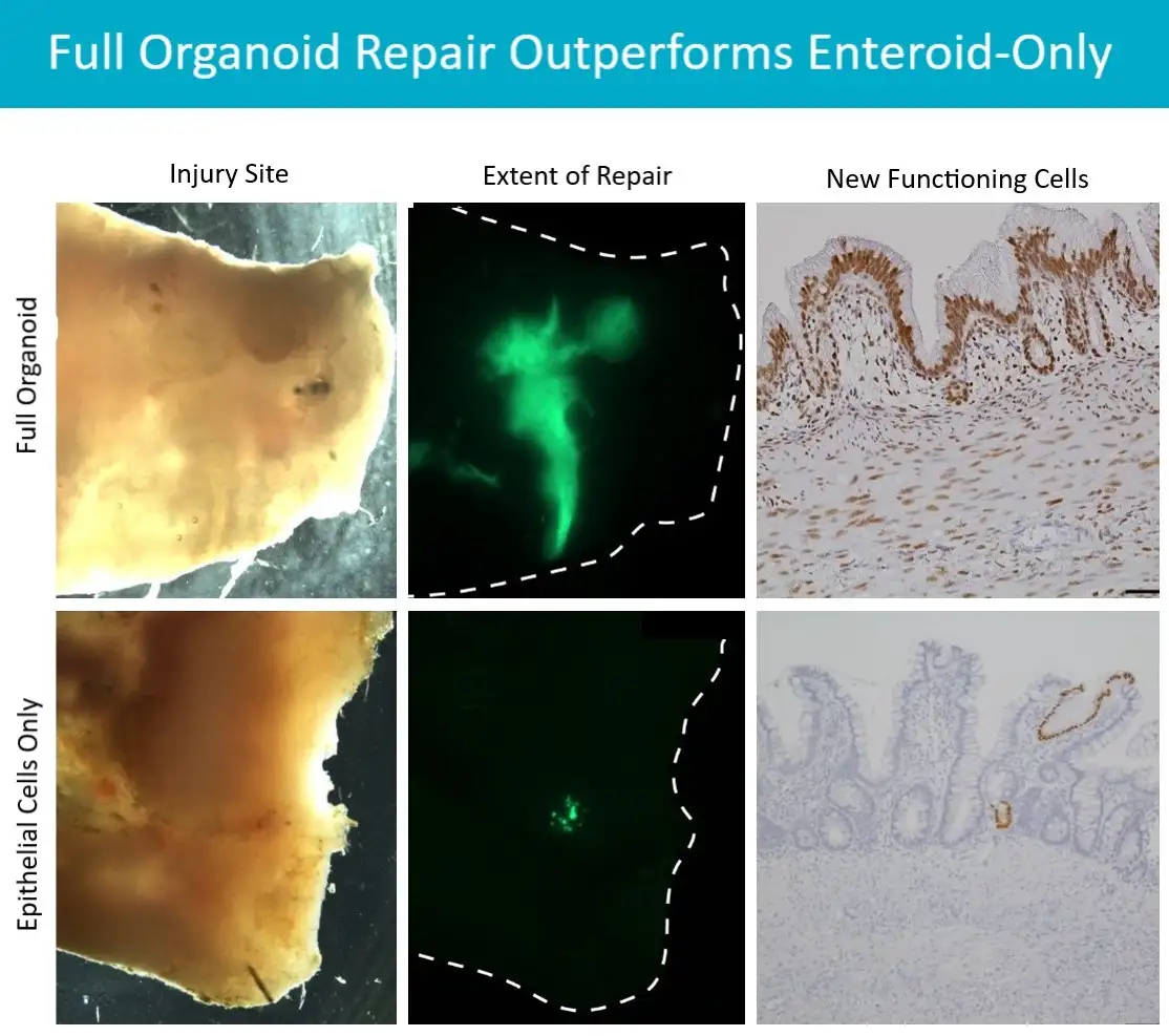 Images compare two methods for using cellular therapy to repair damaged intestine in a rodent model.