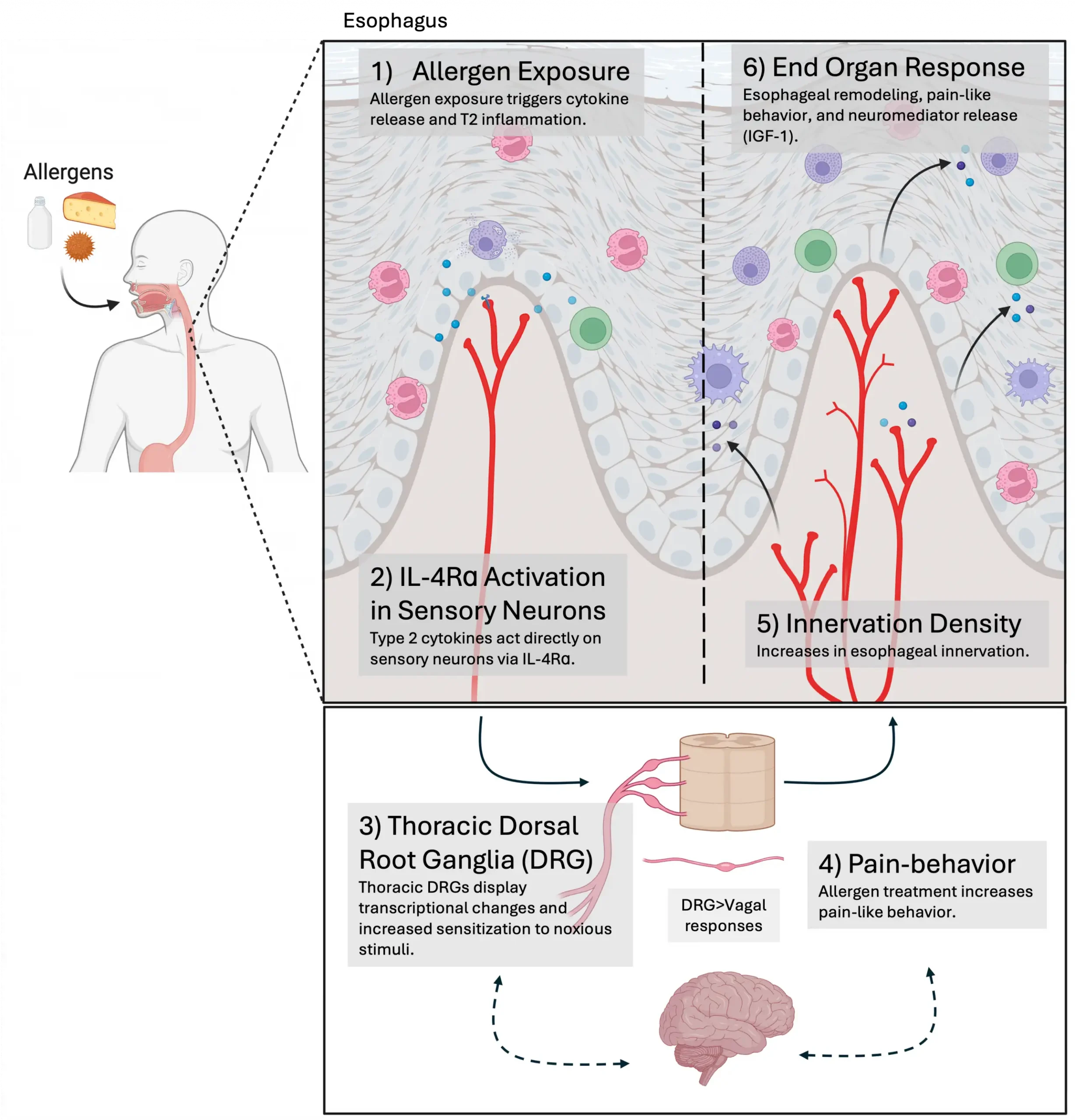 Scientific illustration showing how allergic inflammation and sensory nerves interact in eosinophilic esophagitis (EoE). On the left, common allergens are depicted entering the esophagus. The main diagram outlines a six-step process: allergen exposure triggers type 2 inflammation and cytokine release in the esophageal lining; inflammatory signals activate IL-4Rα on sensory neurons; nerve signals travel through thoracic dorsal root ganglia and neural pathways associated with pain responses; allergen exposure increases pain-like behavior; esophageal innervation increases as sensory nerve fibers expand within the tissue; and interactions between nerves, immune cells and esophageal tissue contribute to remodeling, pain-related responses and release of neuromediators. Arrows connect each step to illustrate the neuroimmune circuit identified by researchers and its role in inflammation, nerve growth and symptoms associated with EoE.